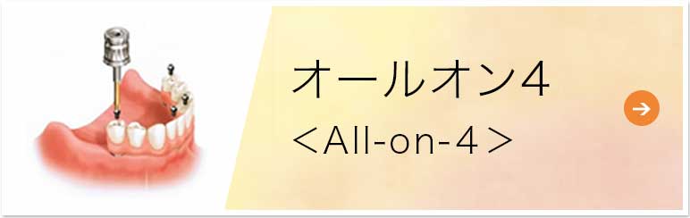 allon4 オールオン4