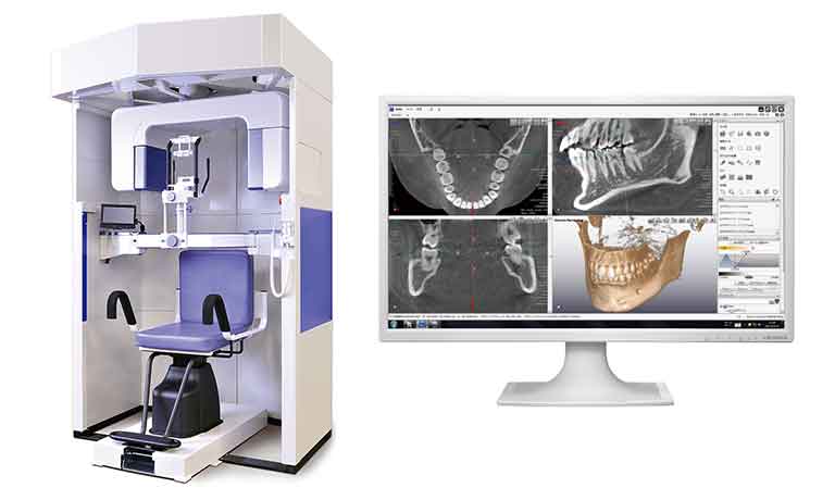歯科用CT