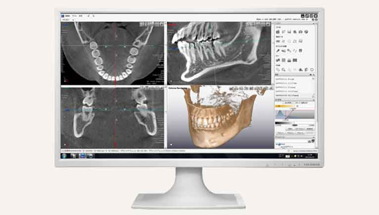 歯や骨の立体的な状態がわかる