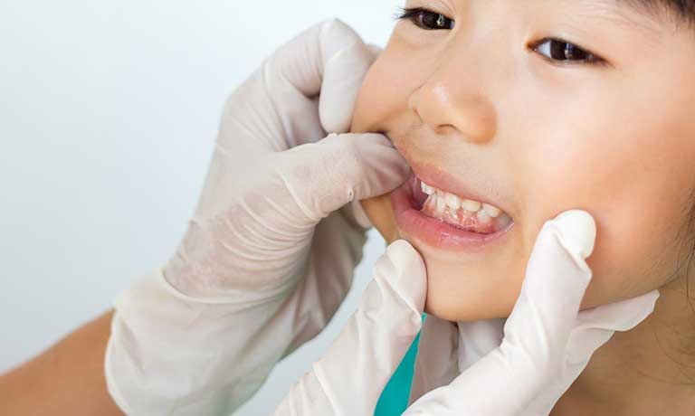 子供の歯の診察の様子