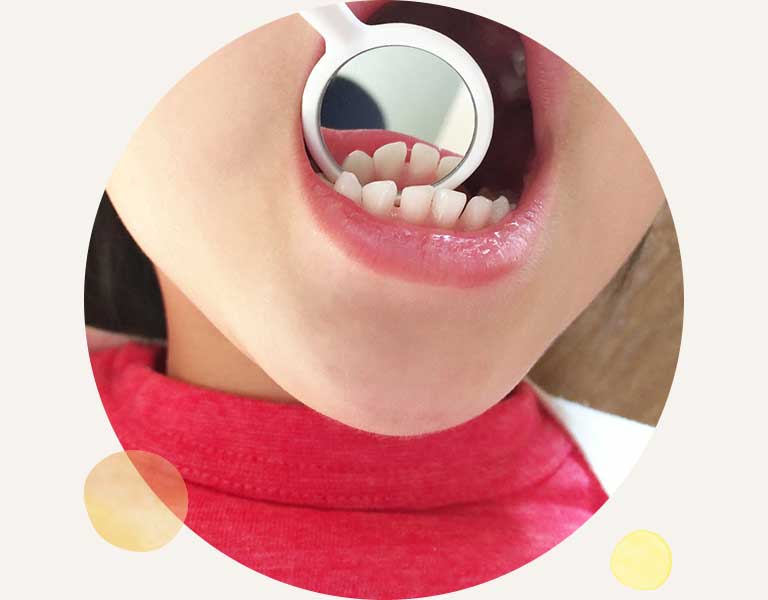 子供の歯並びの確認の様子