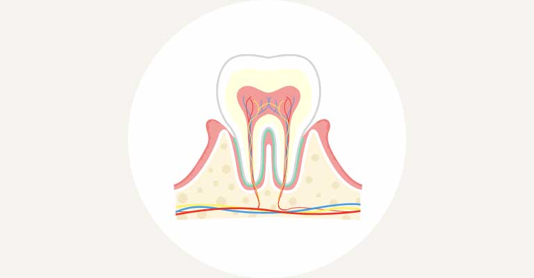 歯肉炎イラスト