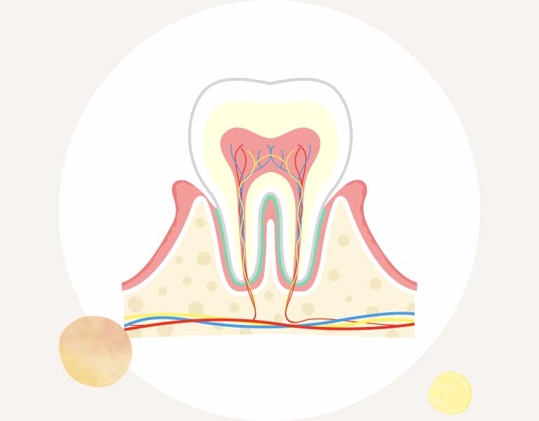 歯肉炎イラスト